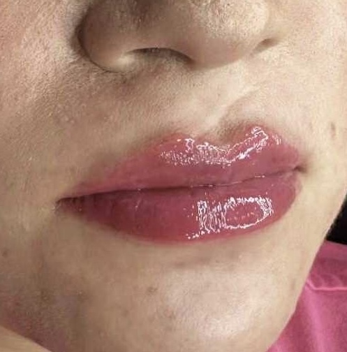 OG Mini Plump (Touch Up 0.5ml) at Kissable Curves in TX, TX