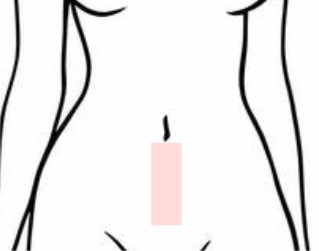 Stomach Strip