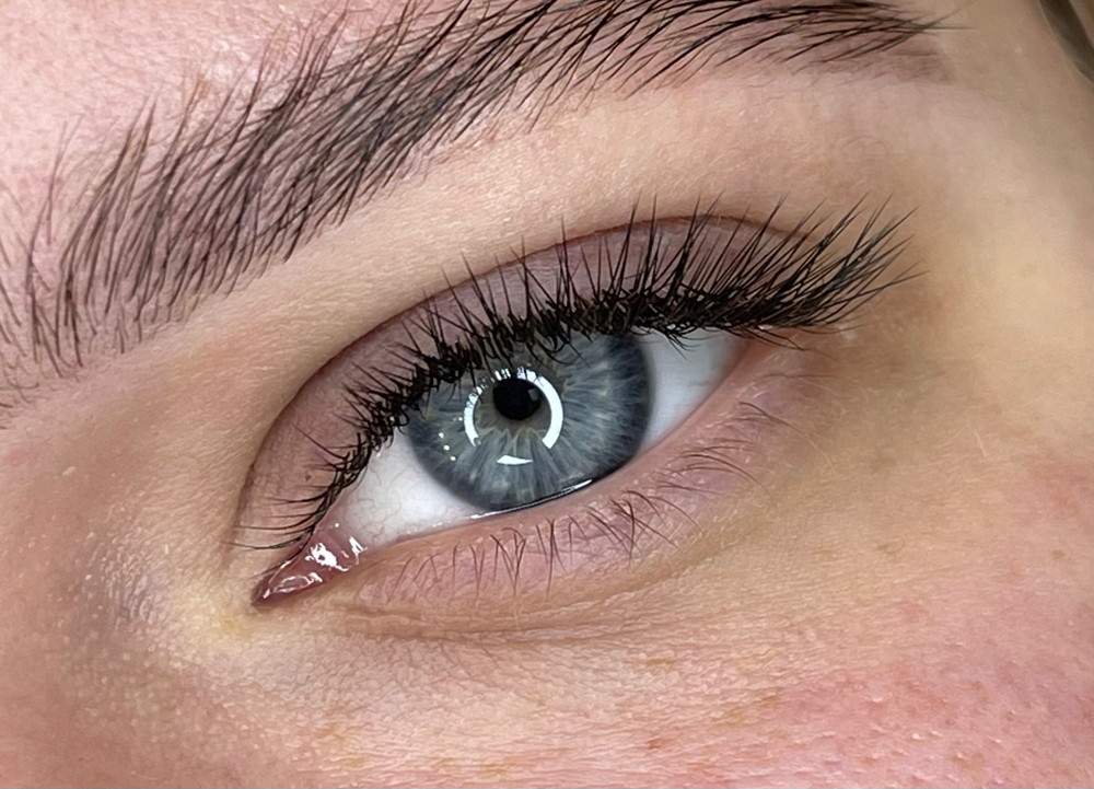 Classic Fill 3 weeks