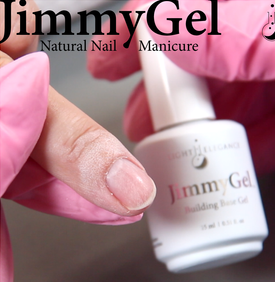 Jimmy Gel