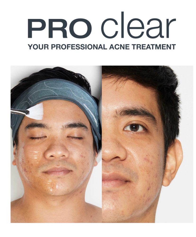 ProKlear Treatments