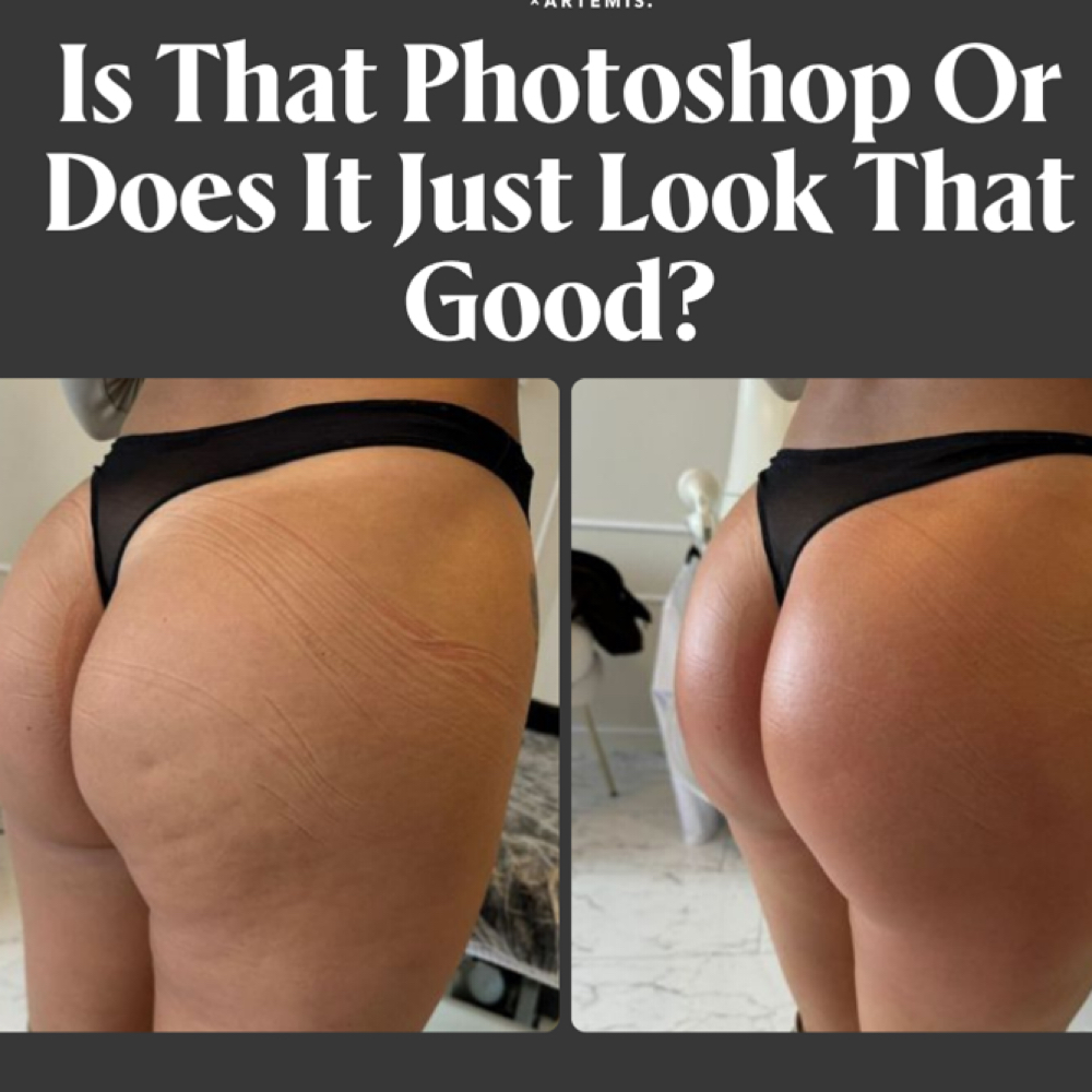 Aesthetic Sculpt Pro