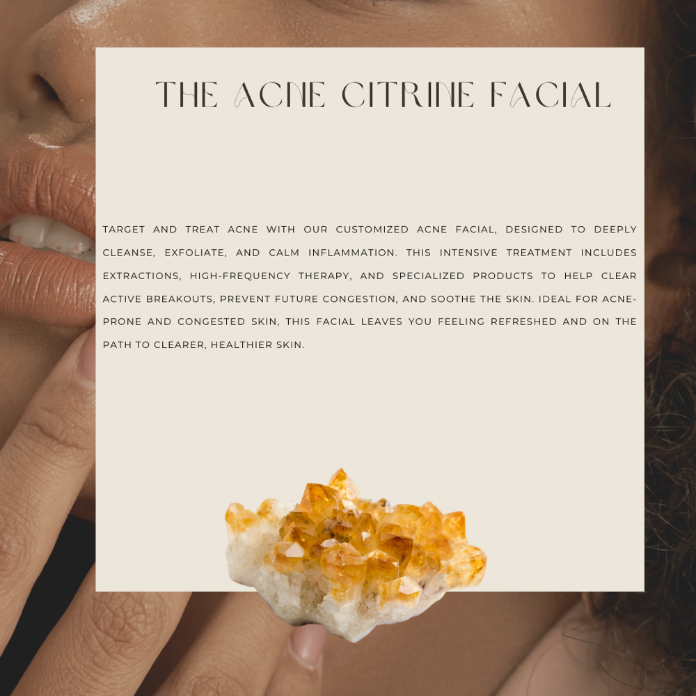 THE ACNE CITRINE FACIAL✨