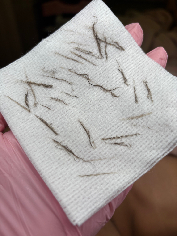 Dermaplaning Facial at Beautiful Glow By Yeimi in Tampa, FL