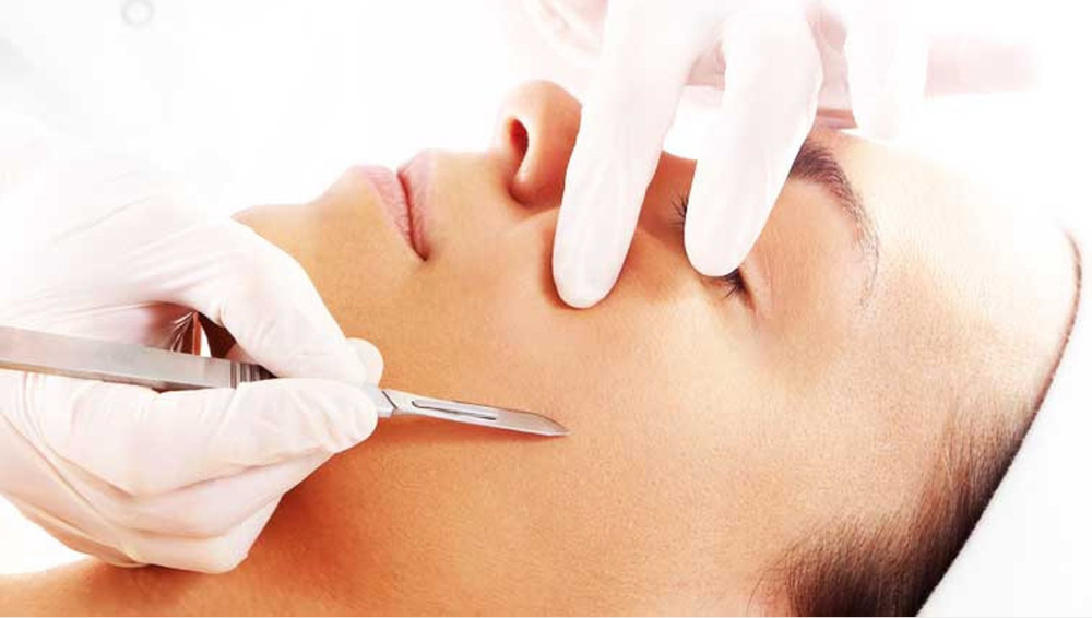 Dermaplaning Facial