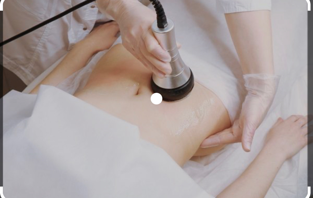 Ultrasonic Fat Cavitation