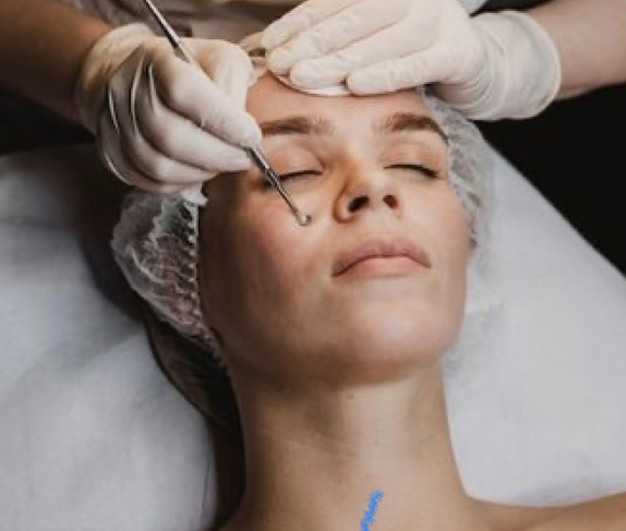 Deep Pore (Acne) Facial