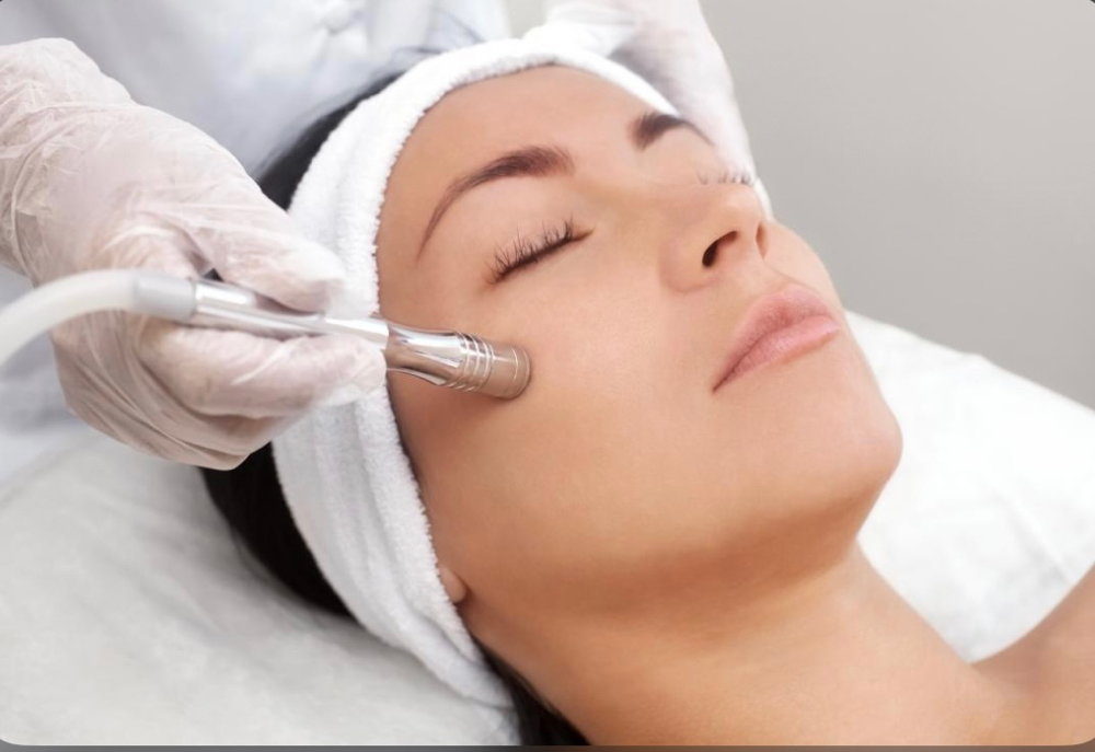Microdermabrasion