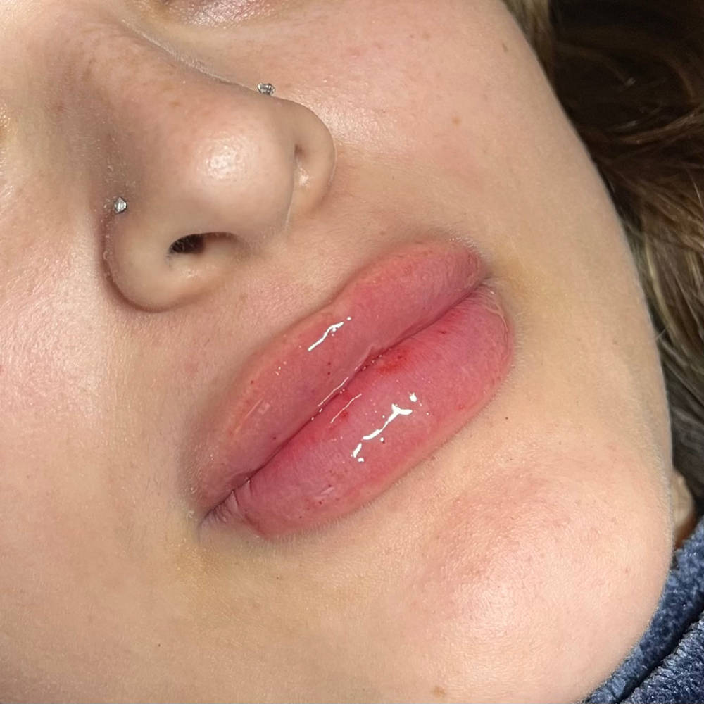 SPECIAL• 1ML• No Needle Lip Filler at The Glow Up By Jennifer in Austin, TX