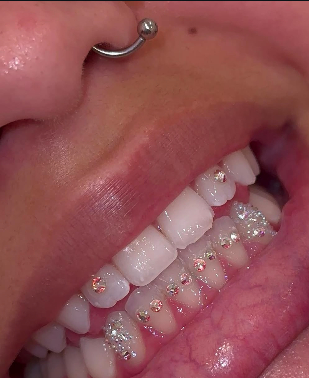Tooth Gems