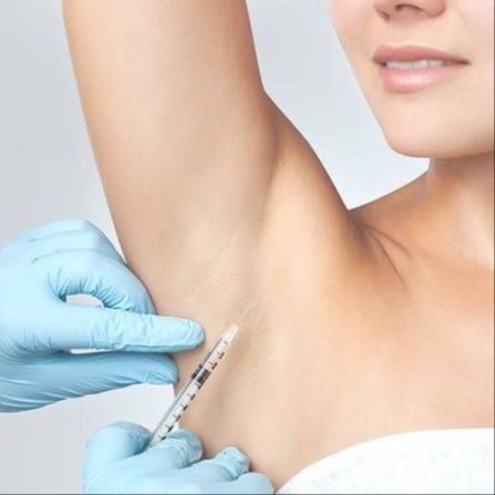 BOTOX UNDERARMS