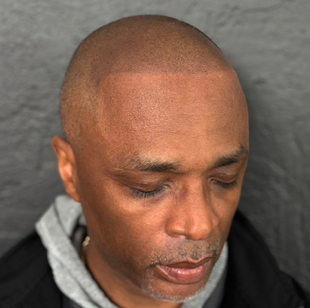 Scalp Micropigmentation at The Bar Aesthetics in Pinole, CA