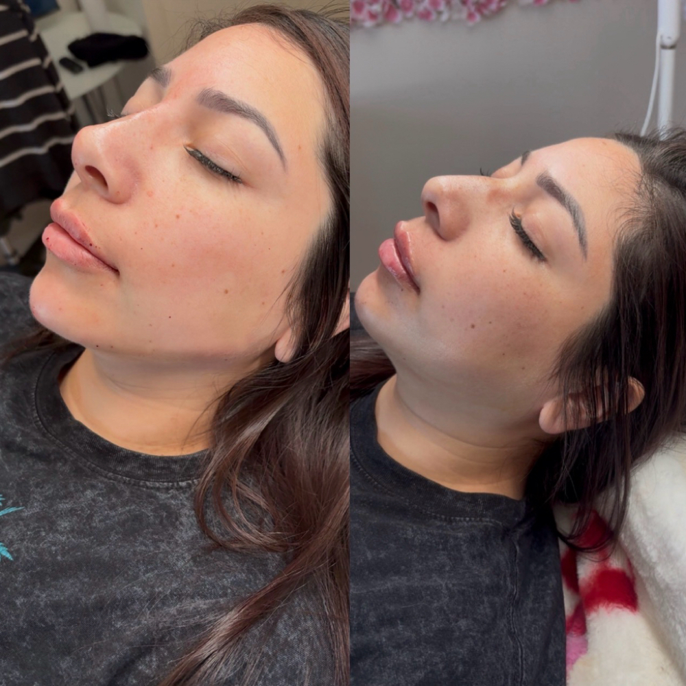 The Elite Balance 6 Ml at Balance.Bar.Aesthetics in Berkeley, CA