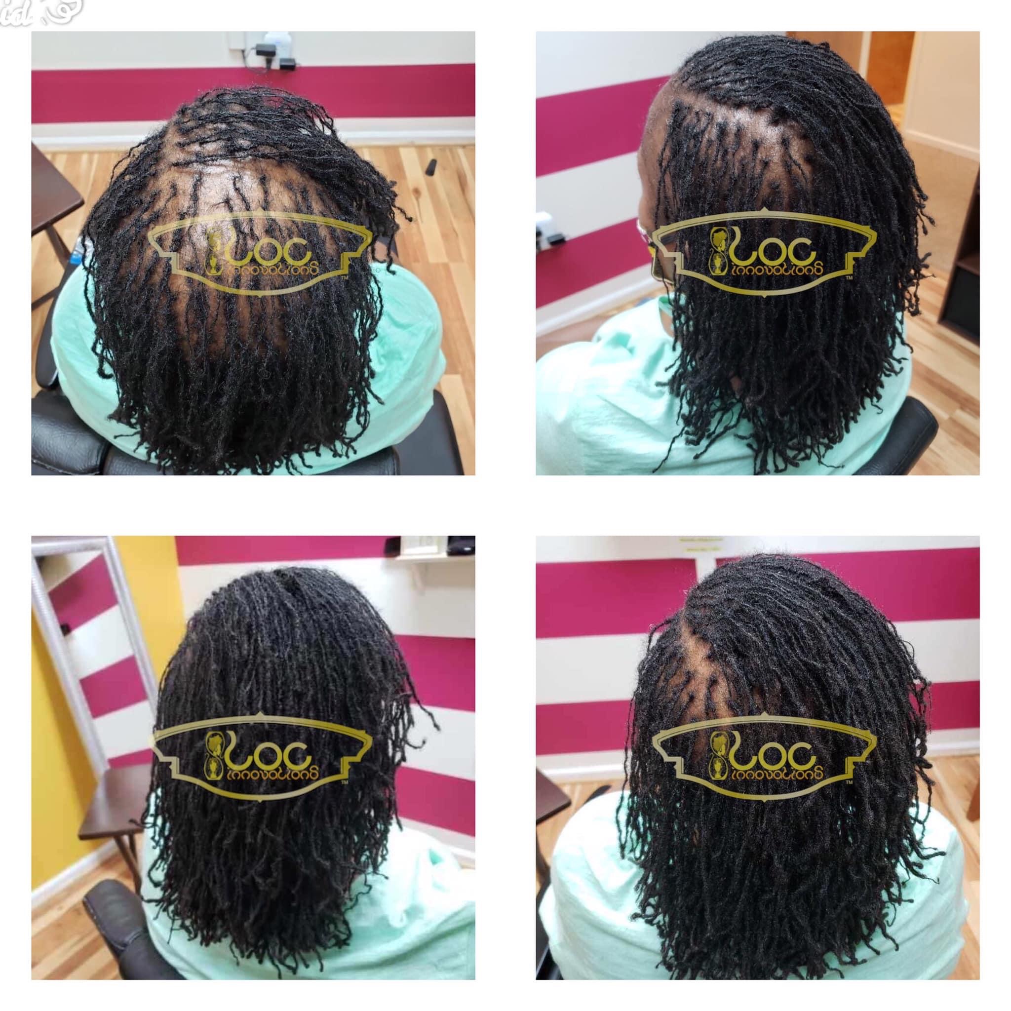 💎 LOC CRANIAL MAINTENANCE