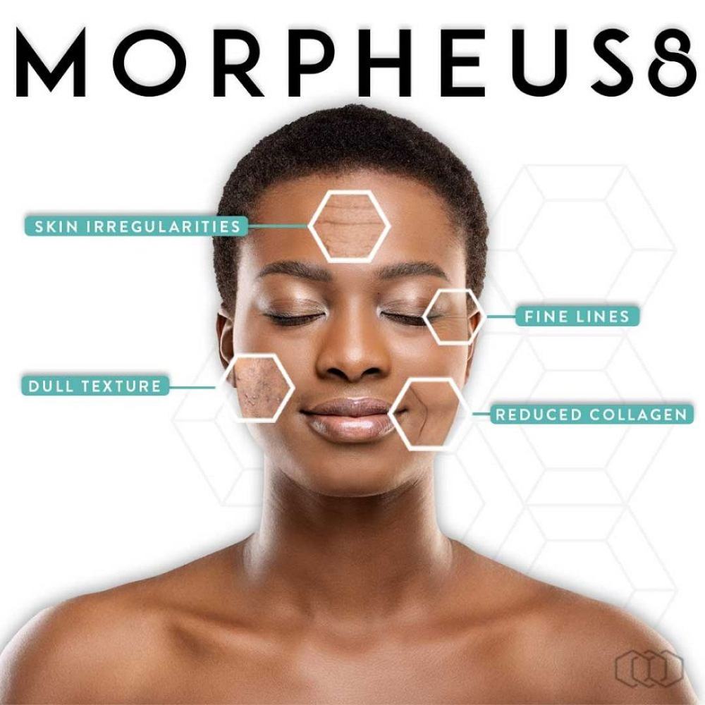 Morpheus8 Full Face