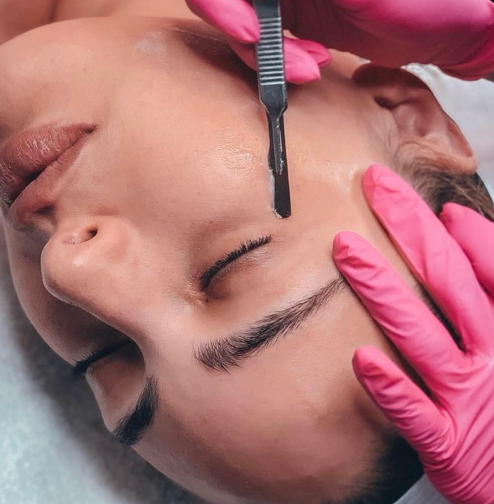 Dermaplaning