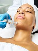 Microneedling