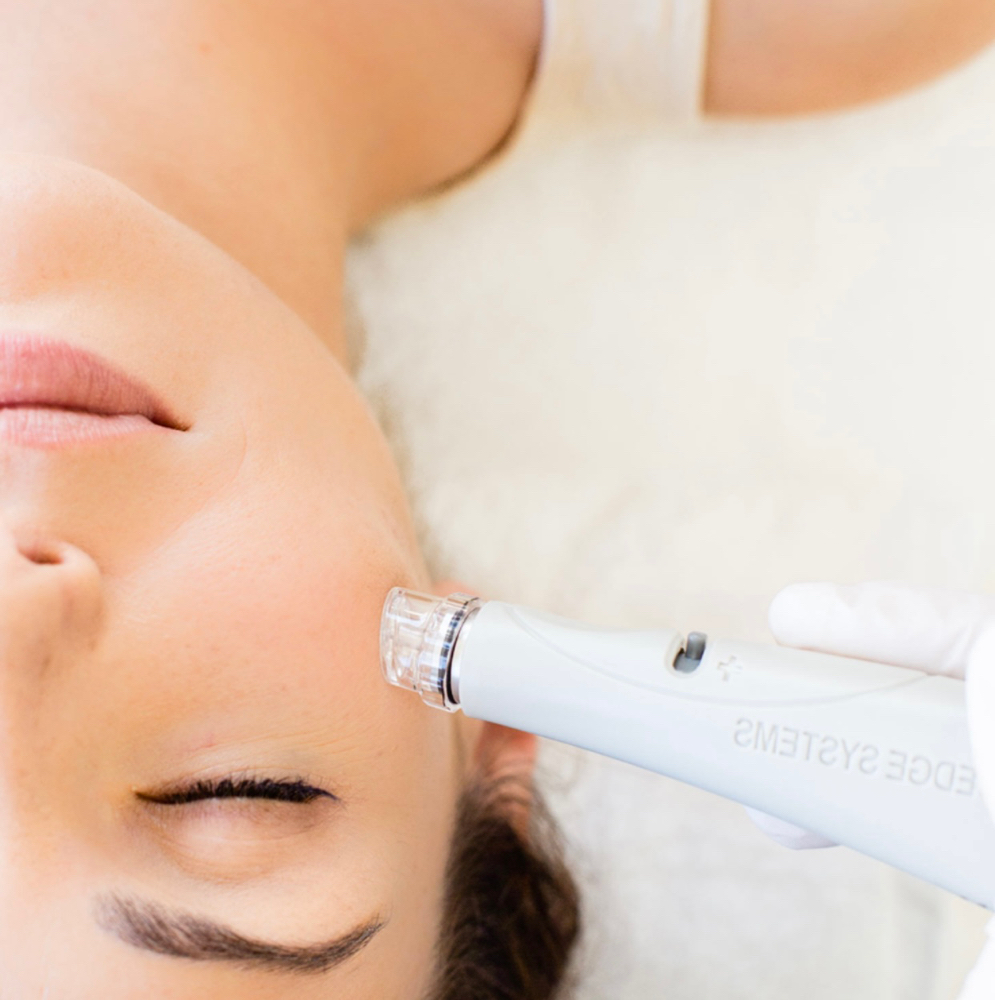 Hydrodermabrasion & Oxygen Facial