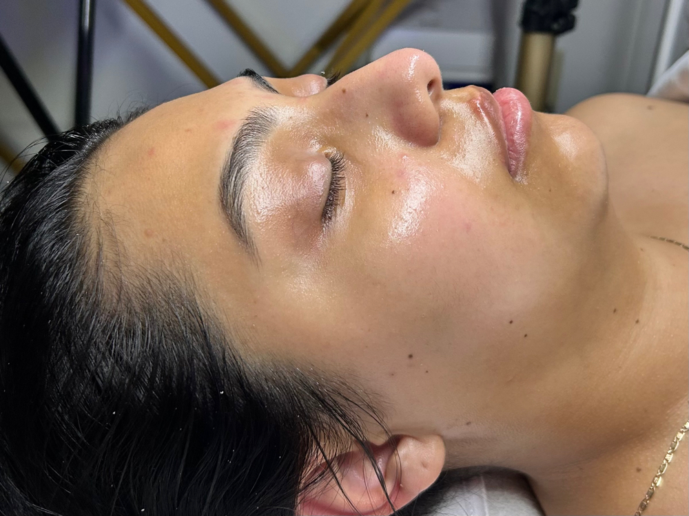 Signature Hydrafacial
