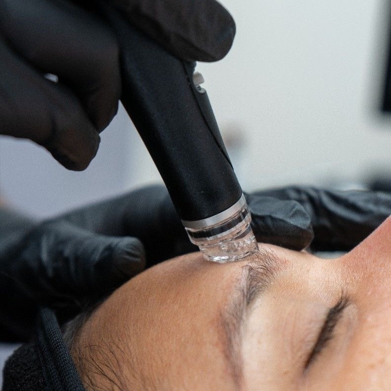 Hydrafacial at Milan Luxury Medspa in Spring, TX