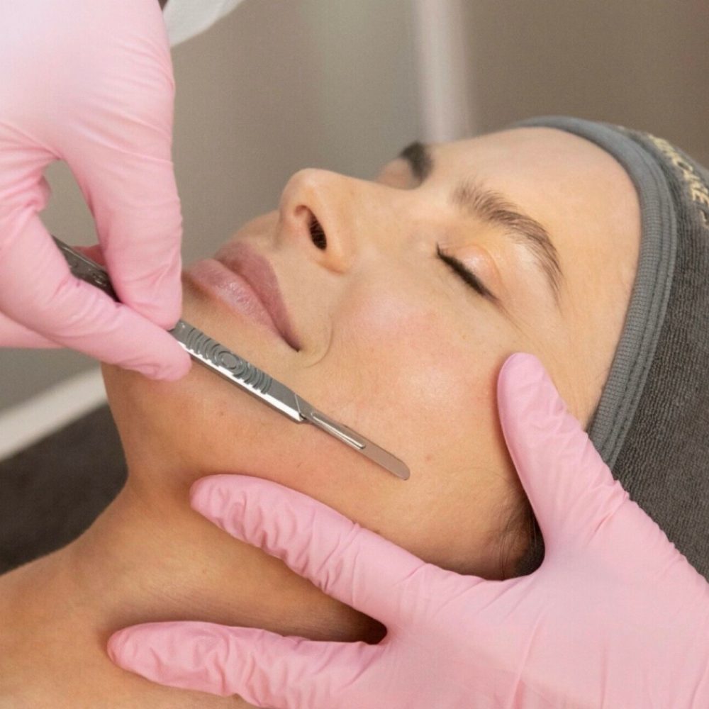 Dermaplanning at Glamorous Brows|Skin|Lashes in Cedar Hill, TX