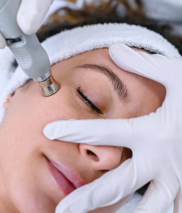 Microdermabrasion Facial