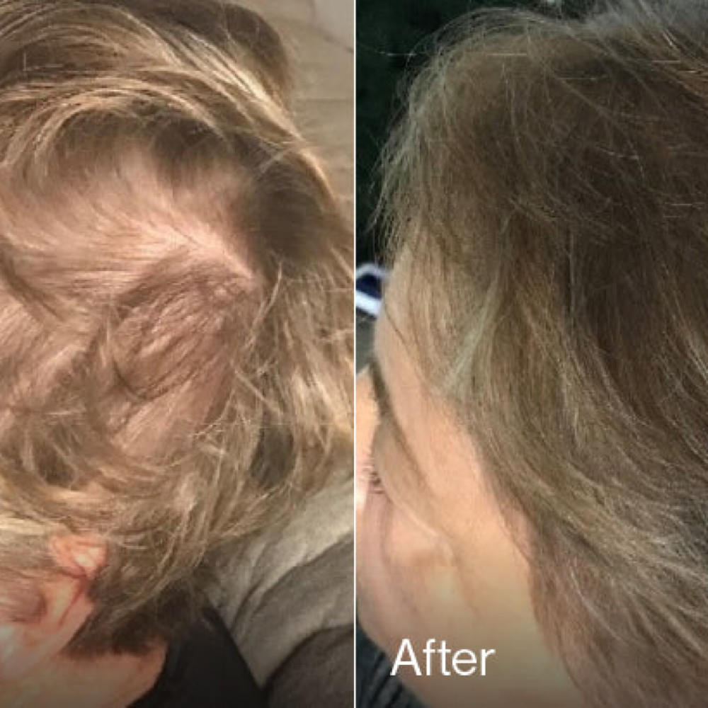 ⭐️ Signature Hair Restoration ⭐️ at The Glow Studio in Sioux Falls, SD