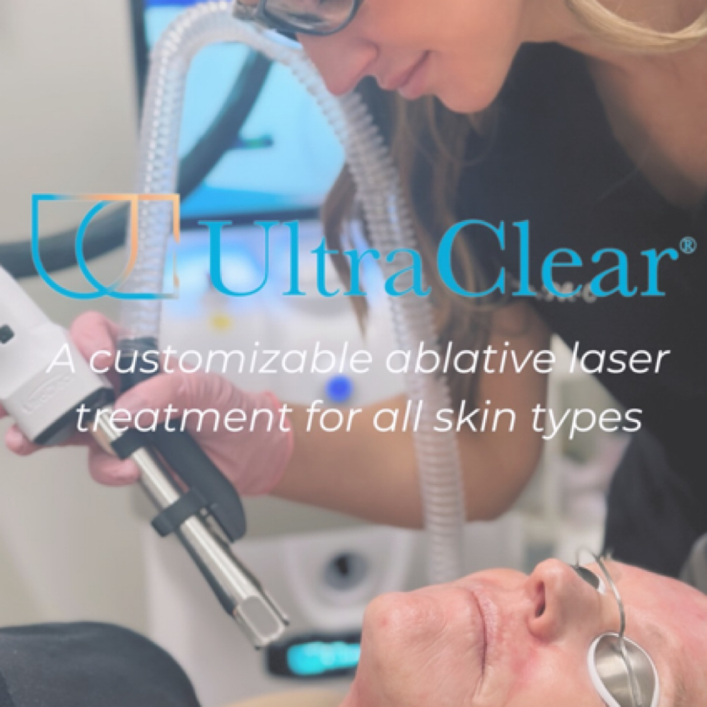 UltraClear Laser Consultation at Mökki Aesthetics in Kalispell, MT