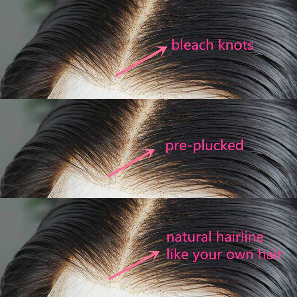 Bleached Knots/Plucked Hairline