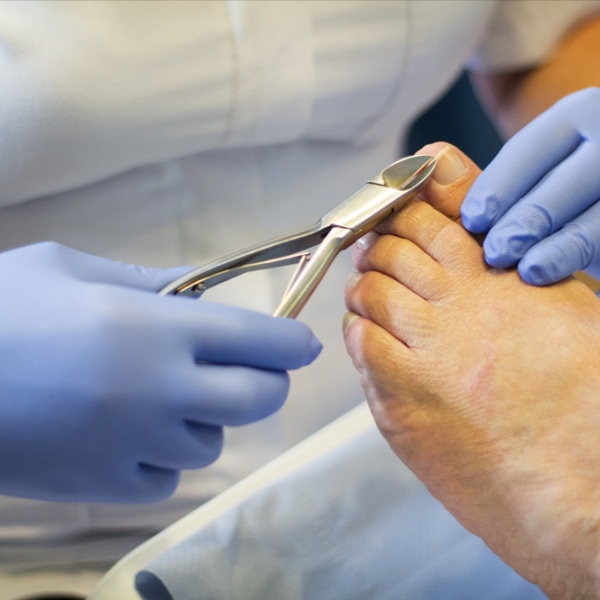 Advanced Toenail Care  (Maintenance at Meraki FootCare in Dayton, OH