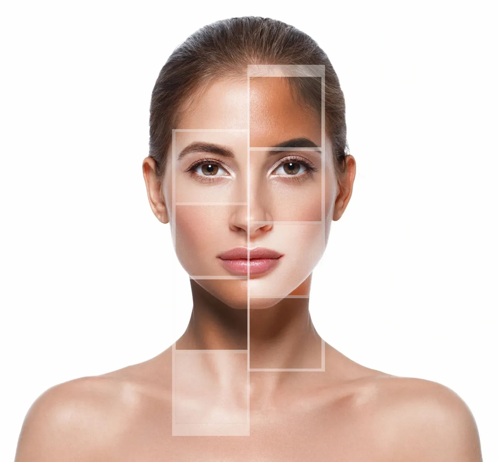 Tri Facial  lift