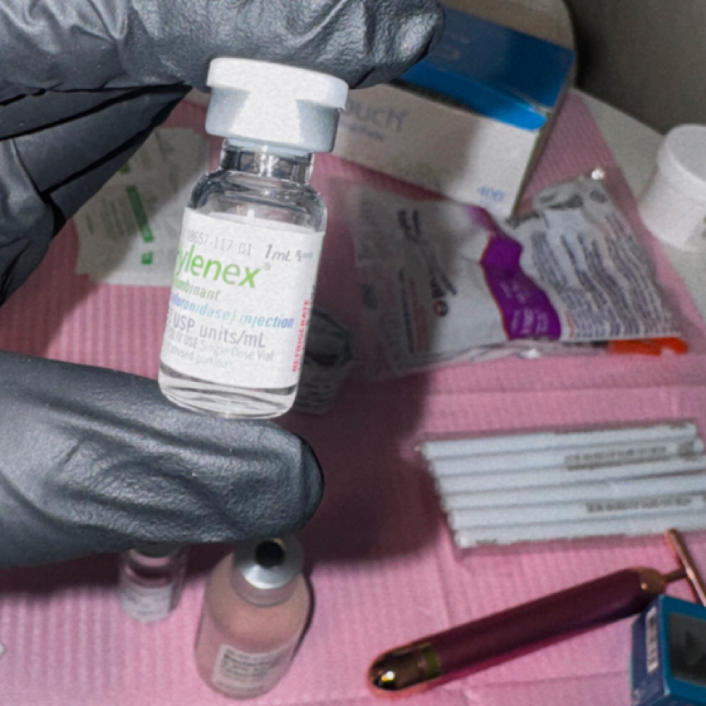 Filler Dissolving at Adrienne Hope’s Aesthetics in Denver, CO