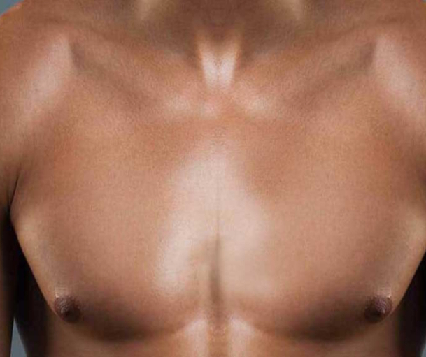Chest (Full)