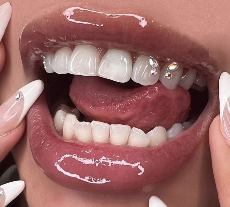 TOOTH GEM 💎🦷