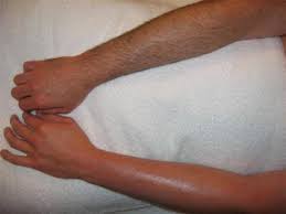 Full Arm