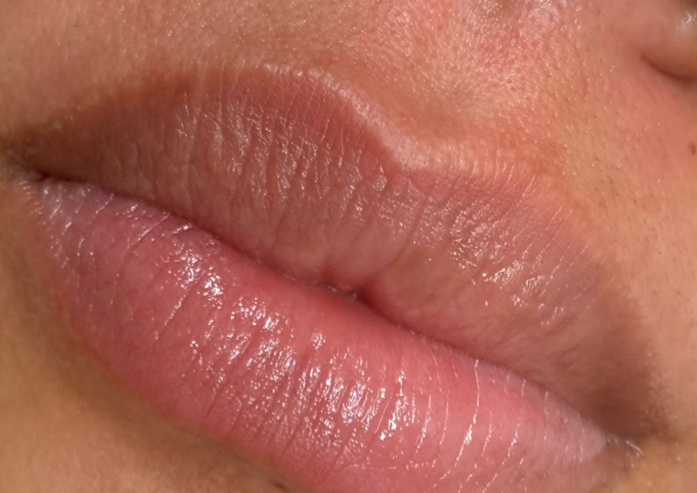 Upper Lip