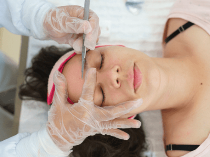 Express Dermaplaning