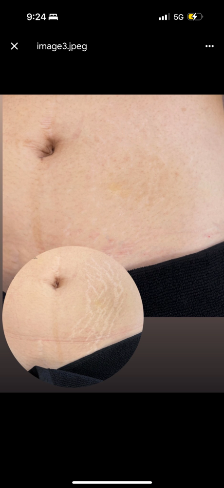 Paramedical Tattooing Consult