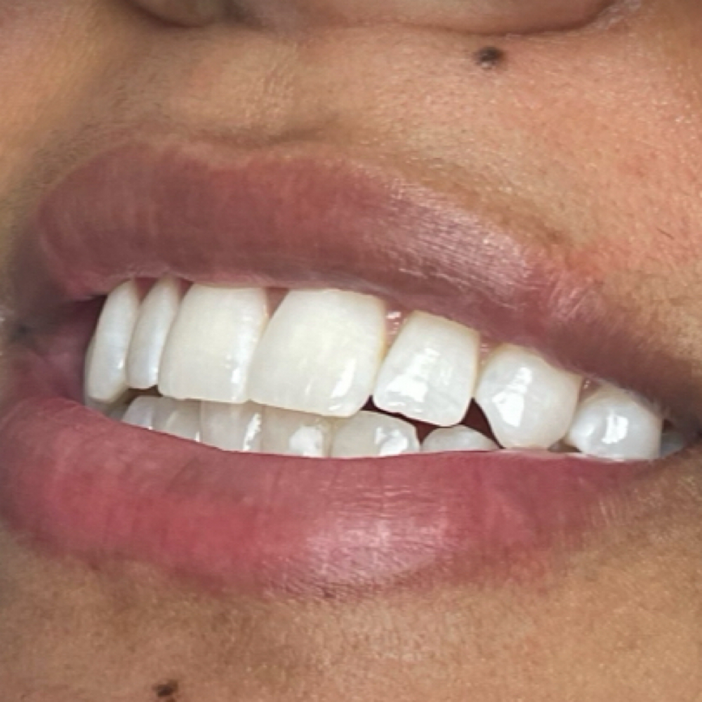 20-30 Min Whitening Session at Deeper than Skin in Fayetteville, NC