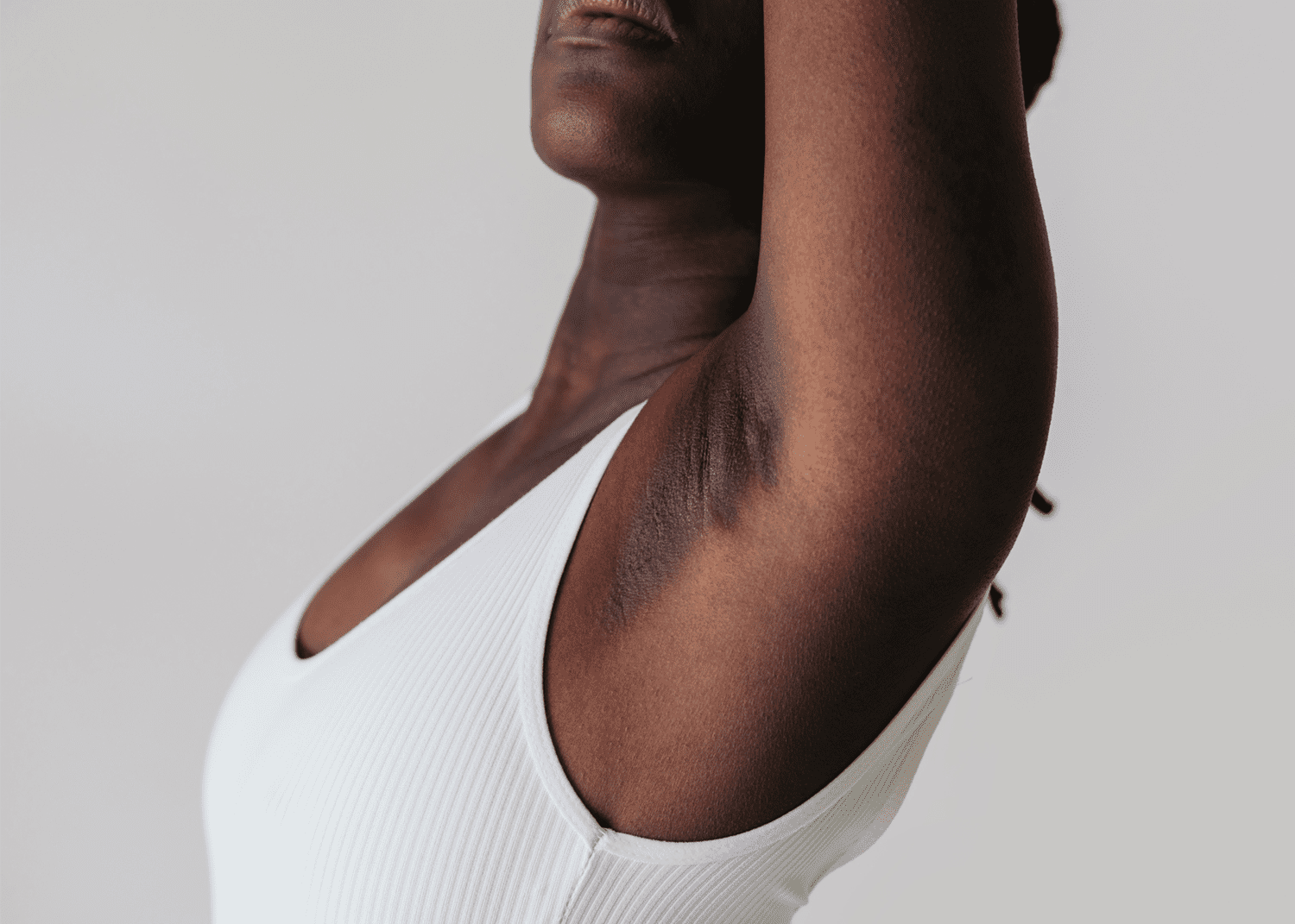 Underarms