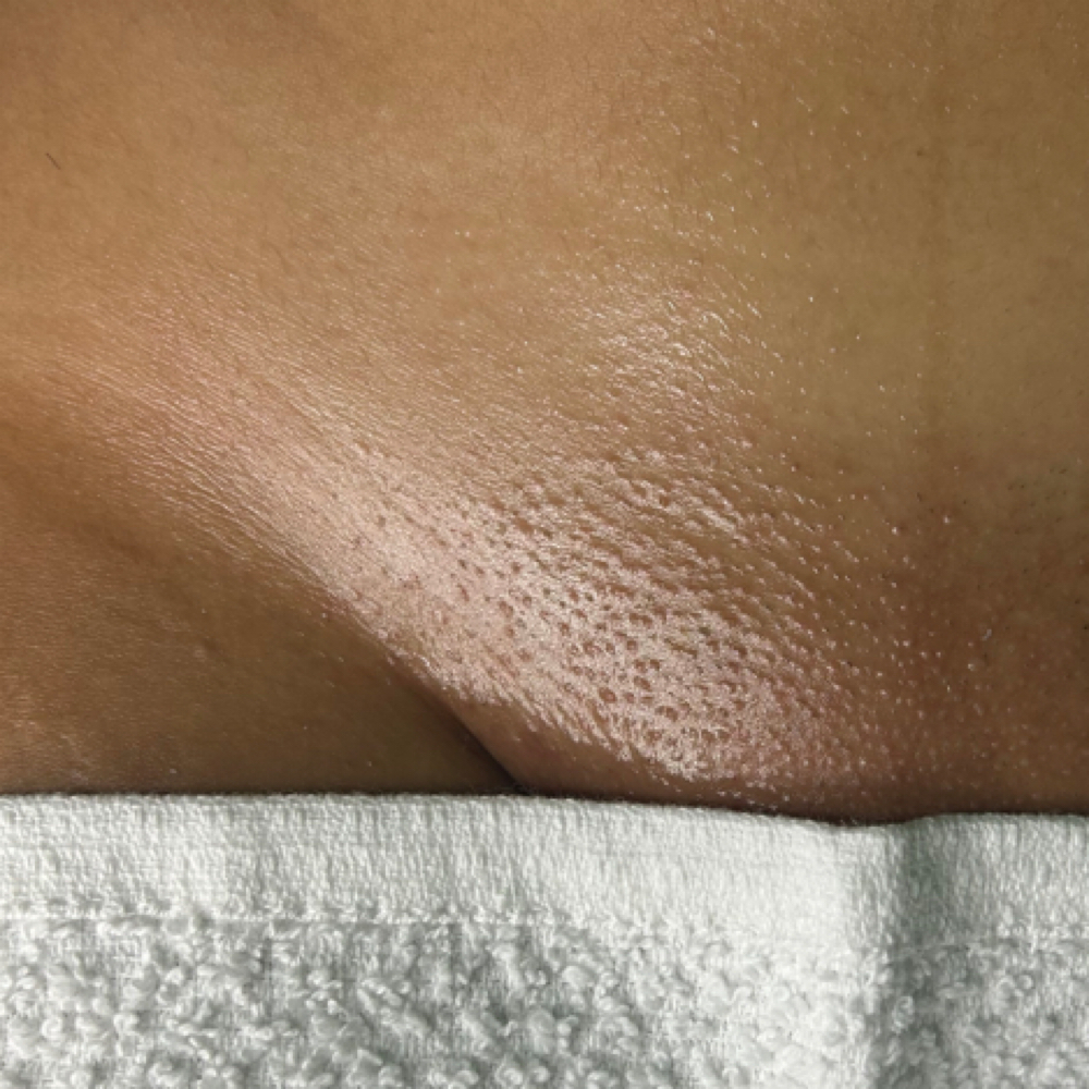 Brazilian Wax at Crista Skin Studio in Lake Mary, FL