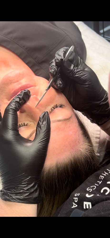 Dermaplaning