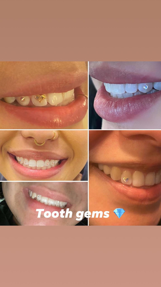 Tooth Gems