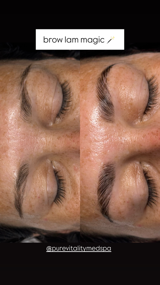 Brow Lamination