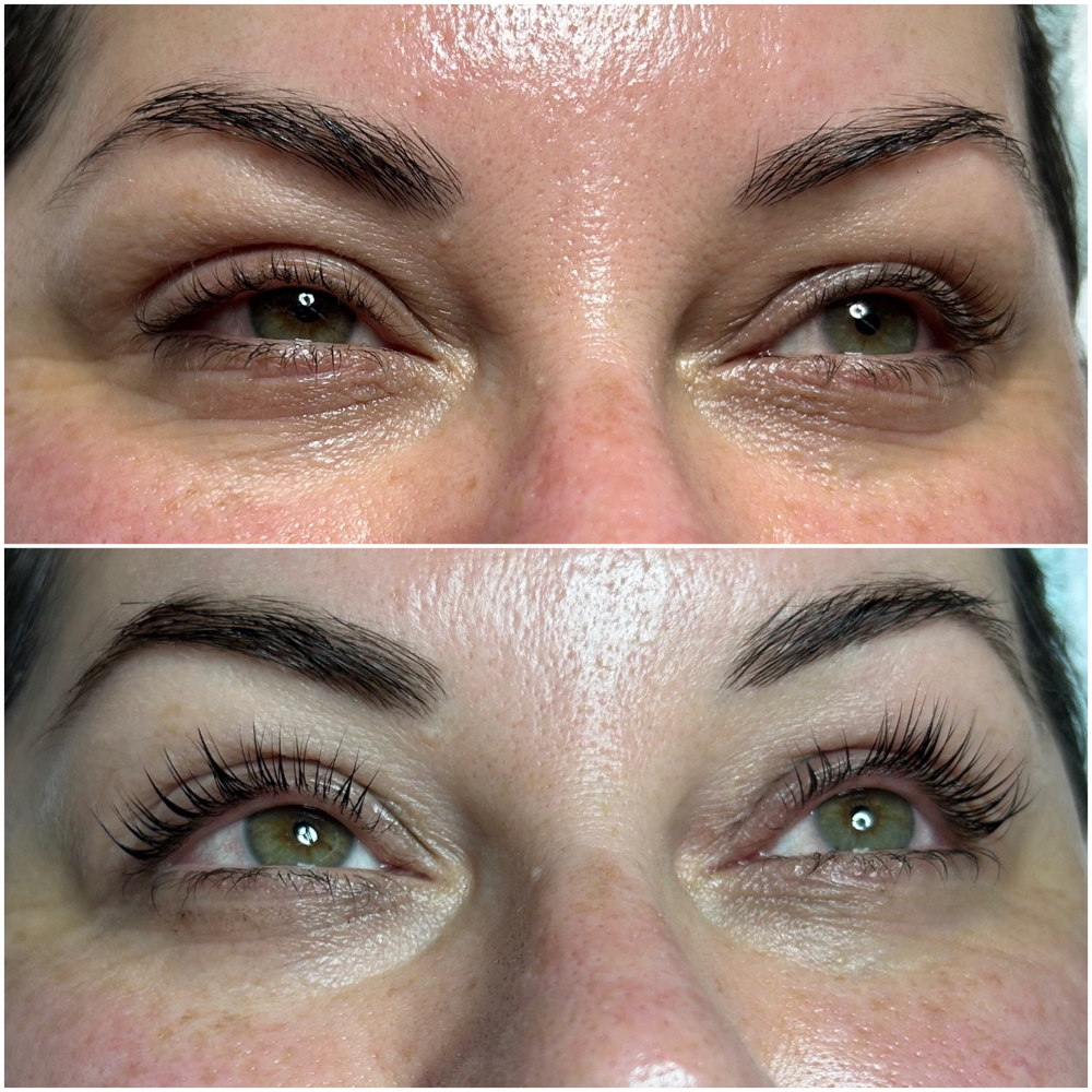 Lash Lift