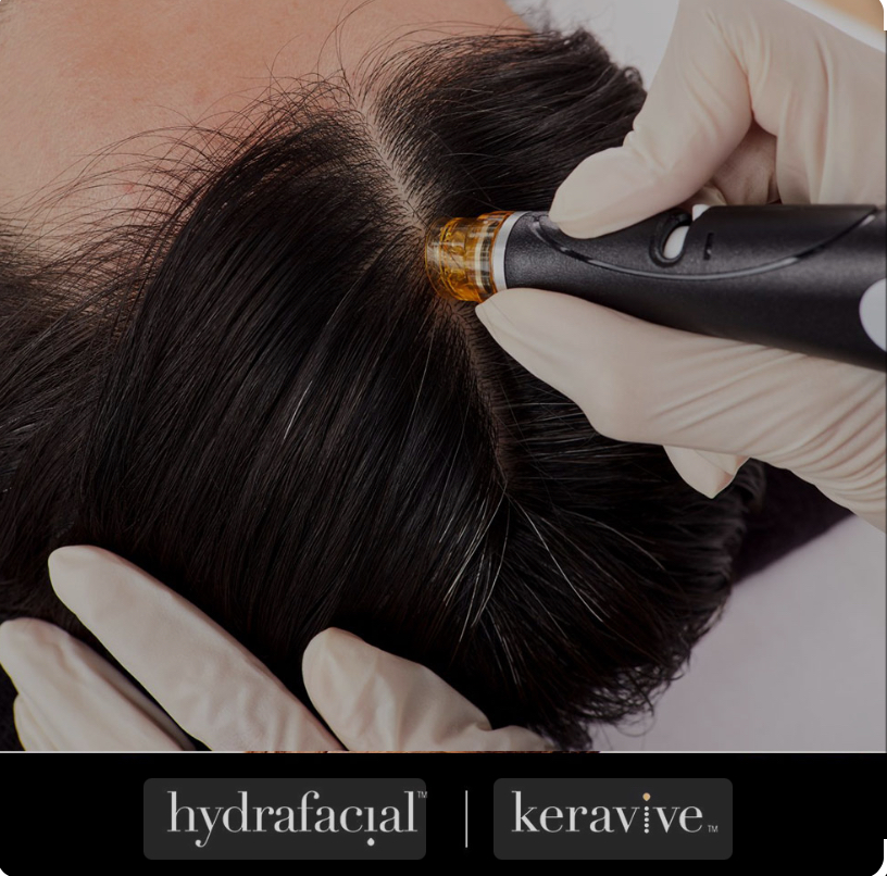 KERAVIVE Scalp Treatment