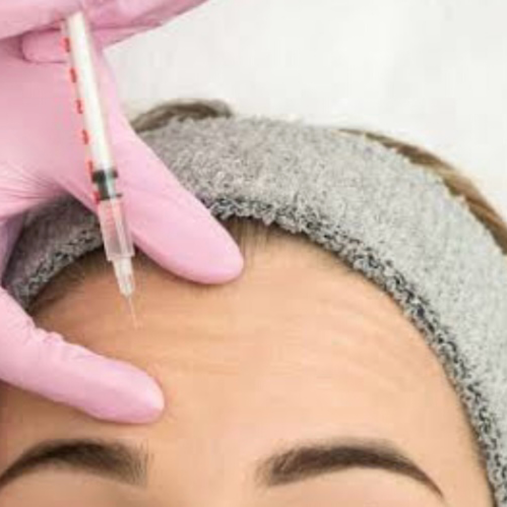 Forehead Botox at Glow Studio in San Antonio, TX