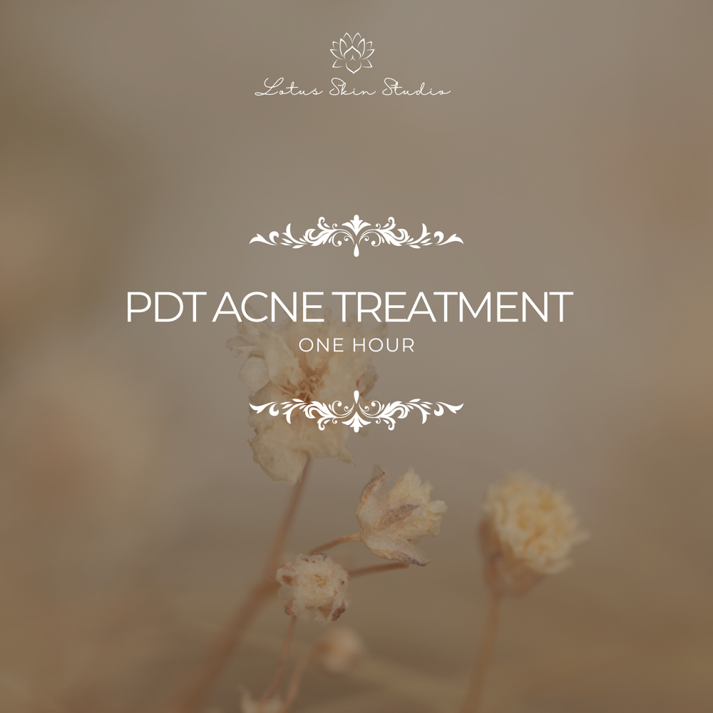 PDT Acne Clarifying Treatment at Lotus Skin Studio in Sumterville, FL