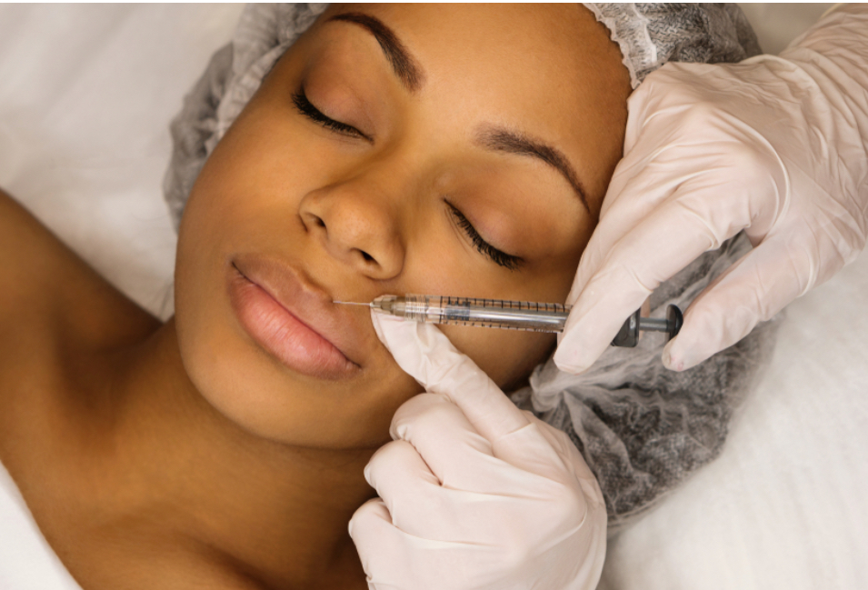 Dermal Filler