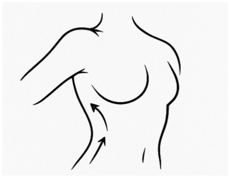 Package Of 5 Lymphatic Massages